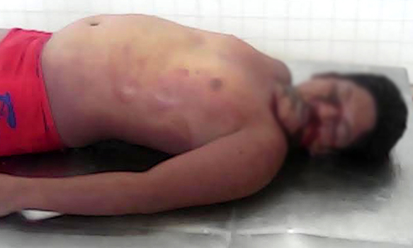 Se le atoró la semilla de mango