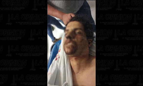Muere taxista golpeado y con un balazo en la cabeza