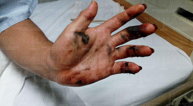 balean-a-joven-en-la-colonia-petromex