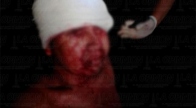 muere-taxista-que-recibio-brutal-golpiza