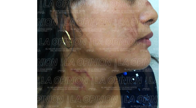Casi estrangula a su expareja casi-estrangula-a-su-expareja