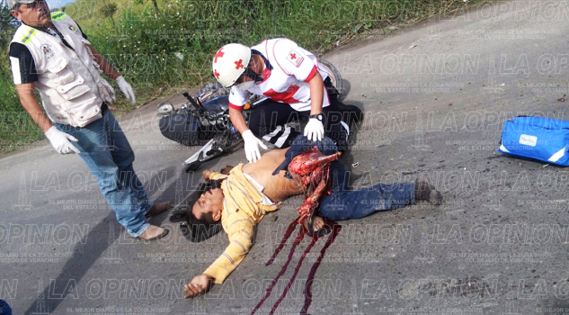 Mutilado por un trailer mutilado-por-un-trailer