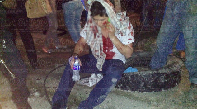 Ataca grupo armado a líder de la CANACO Ataca grupo armado a líder de la CANACO