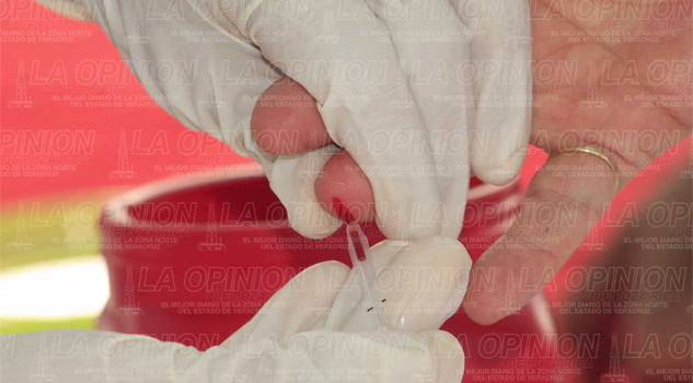 Desaparecen 40 mdp para prevenir VIH Desaparecen 40 mdp para prevenir VIH