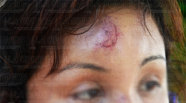 Ebrio taxista golpeó a su esposa Ebrio taxista golpeó a su esposa