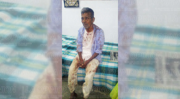 Violento asalto en Zozocolco