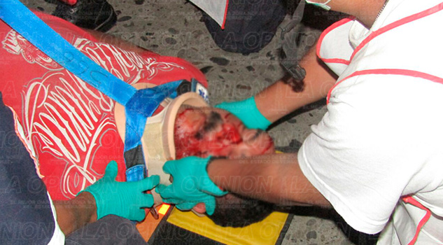 Motociclista sufre violento accidente Violento Accidente Motociclista