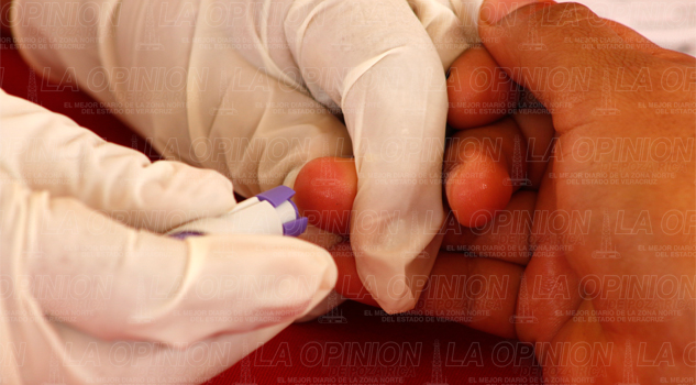 Zozobra por el uso de pruebas de VIH falsas Zozobra por el uso de pruebas de VIH falsas