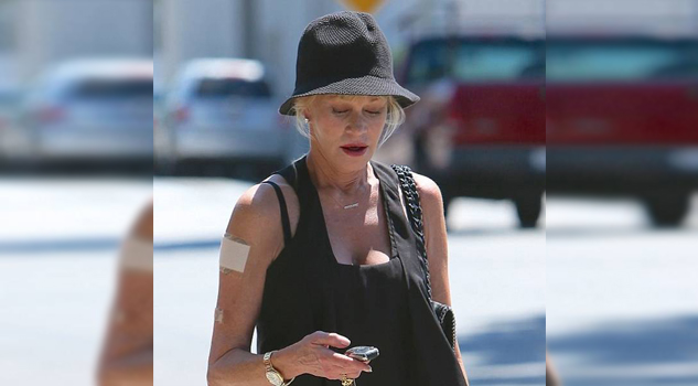Adiós tatuaje; Melanie Griffith borra su recuerdo Adiós tatuaje; Melanie Griffith borra su recuerdo