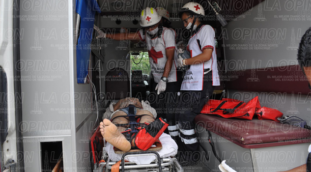 Carpintero se corta los dedos con una sierra Carpintero se corta los dedos con una sierra