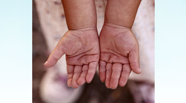 Como castigo le quemó las manos a su nieta Como castigo le quemó las manos a su nieta