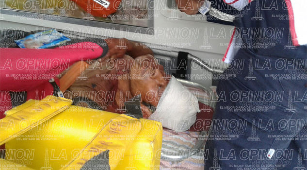 Le abrieron la cabeza de un machetazo Le abrieron la cabeza de un machetazo