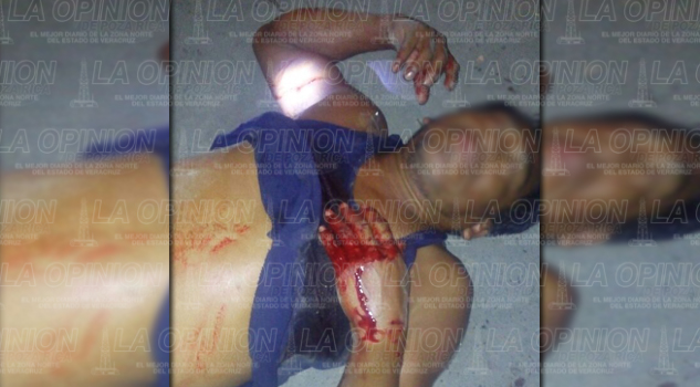 Apuñalan a comerciante tuxpeño Comerciante, atracado y apuñalado