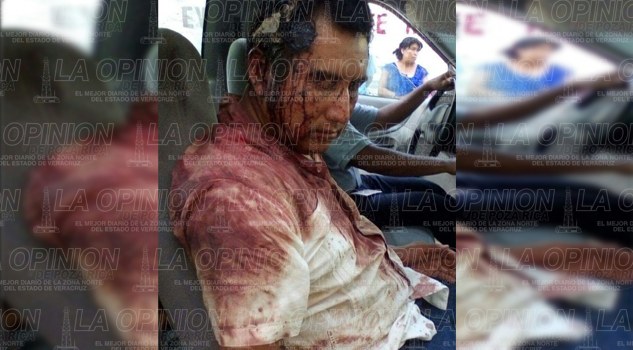 Levantan y golpean a candidato de Morena Levantan y golpean a candidato de Morena