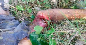 Guatemalteco arrolla y mata a un ciclista