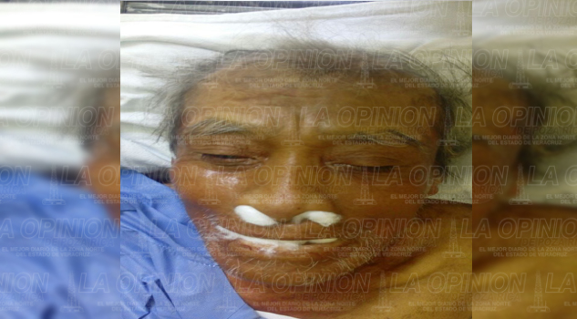 Murió en el hospital y se va a la fosa común Murió en el hospital y se va a la fosa común