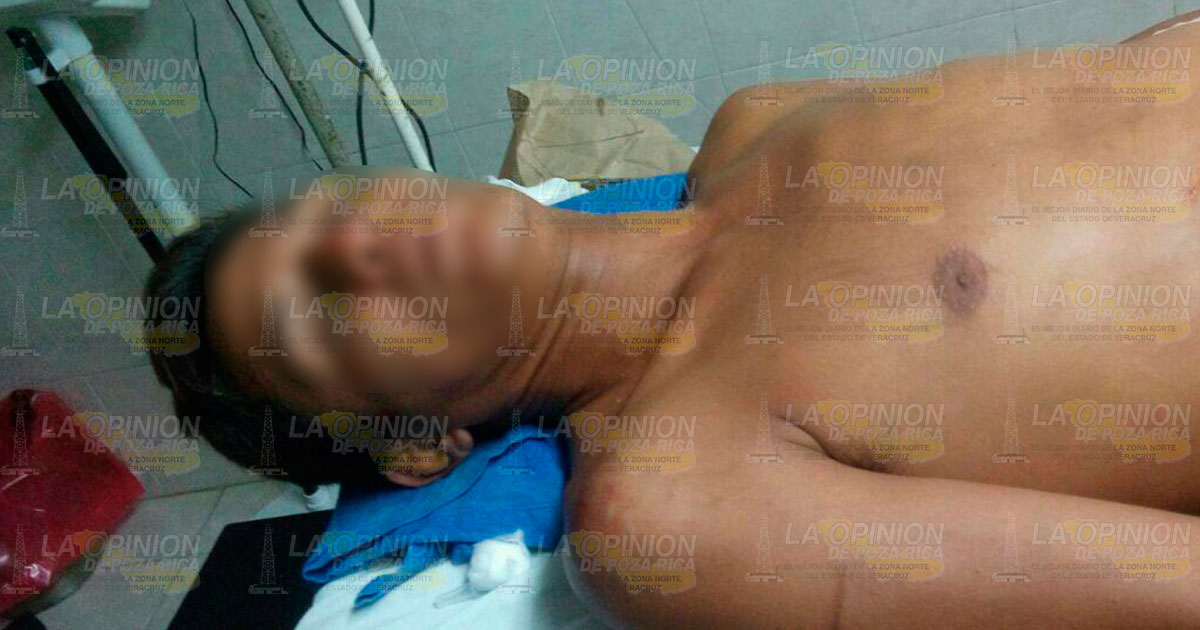 Balean a sujeto en medio de partido de Futbol herido