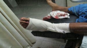 Baleado en la cancha del fut-7