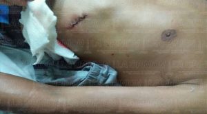 Baleado en la cancha del fut-7