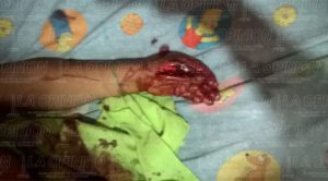 Se hirieron a machetazos y se encuentran graves