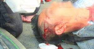 Grave motociclista; fue embestido en la Chapultepec motociclista-arrollado