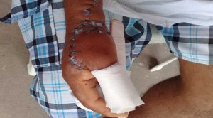 Sobrevive a su peor pesadilla... ser devorado por un tiburón