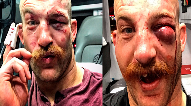 Así es el rostro de un ganador de la UFC ufcpeleador