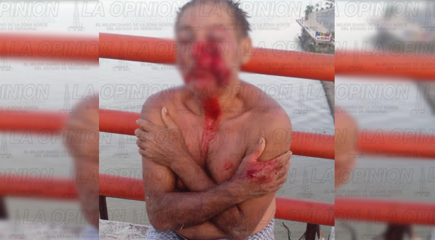 ¡Vive de puro milagro!