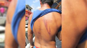 Brutal golpiza a agricultor Agricultor Golpeado