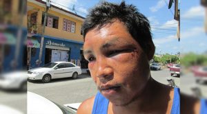 Brutal golpiza a agricultor Agricultor Golpeado