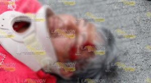 Repartidor se quiebra un brazo al impactarse