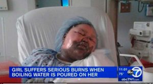 El nuevo reto viral que puede matar a tus hijos, ‘Hot water challenge’