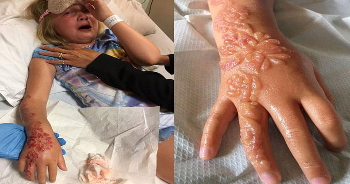 ¡Cuidado con los tatuajes de henna en los niños! los tatuajes de henna en los niñoS