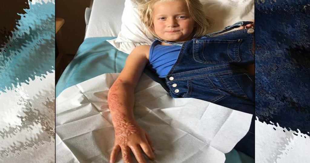¡Cuidado con los tatuajes de henna en los niños!