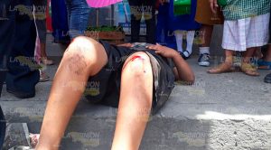 Unidad de TUPR atropella a menor de edad