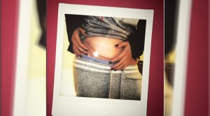 Selena Gomez se sometió a transplante de riñón Cicatriz Selena Gomez Transplante Riñón