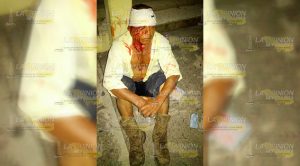 Reportan a sujeto sangrando en Potrero del Llano Reportan Sujeto Sangrando