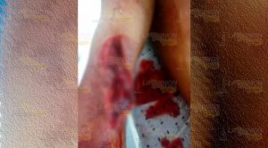 Cuando estaba durmiendo lo acuchillaron