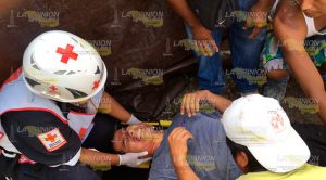 Bulto de cemento le aplastó la cabeza; está grave