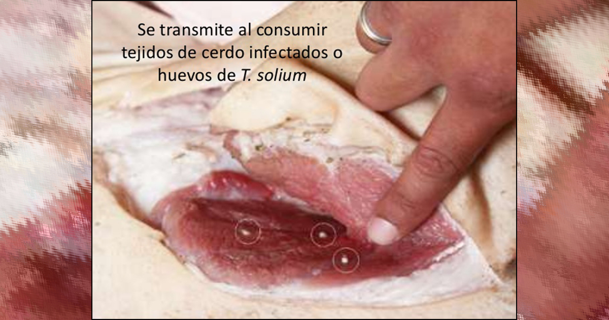 Cisticercosis, mal que podemos adquirir al comer carne neurocisticercosis-6-638