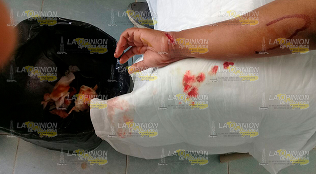 Macheteada por "El Pilo" Macheteada Pilo