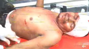 Fallece hombre apuñalado en el Xanath