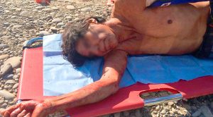 De dos balazos hieren a campesino de Zacate Colorado; está grave