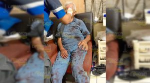 Se fracturó la nariz tras sufrir brutal caída