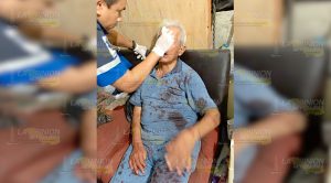 Se fracturó la nariz tras sufrir brutal caída