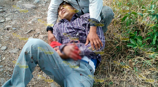 Amputa Mano Picadora Caña