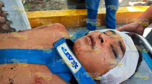 Le dispararon y golpearon, fue localizado en una brecha Dispararon Golpearon Localizado Brecha