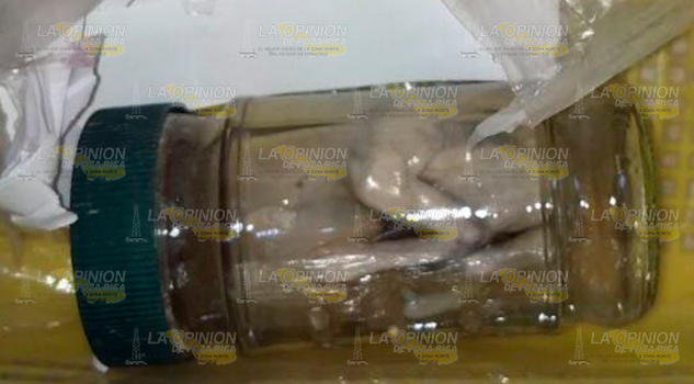 Encuentran Feto Conocida Tienda Telas Centro