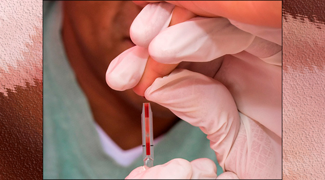 Trabajadores sexuales, con mayor prevalencia de VIH: Censida