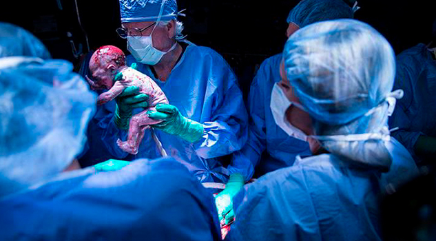 ¡Histórico! Nace primer bebé de un útero trasplantado (Fotos y video)